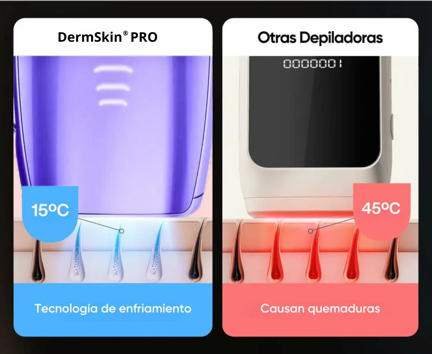 Depiladora IPL permanente