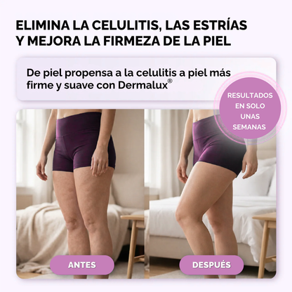 Masajeador de Vacuoterapia